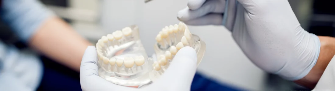 Cirurgião dentista segurando uma protese