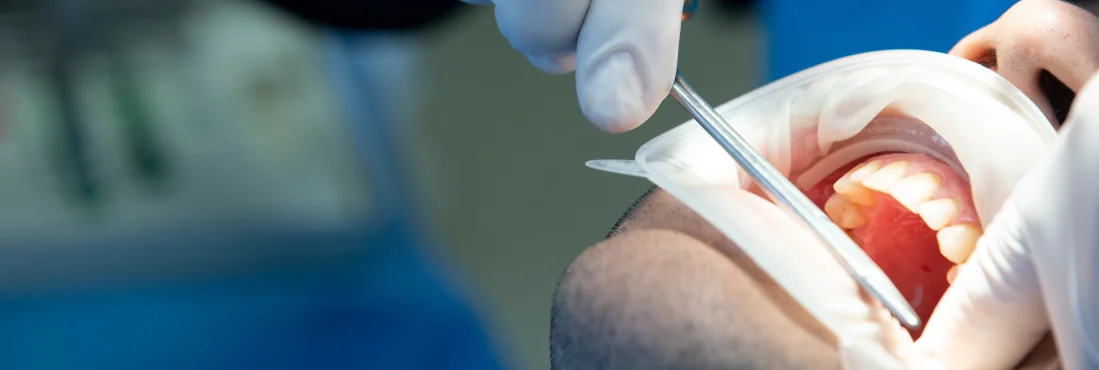 Cirurgião dentista segurando uma protese