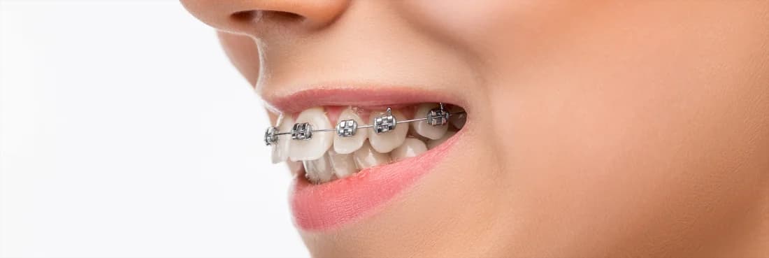 Cirurgião dentista segurando uma protese