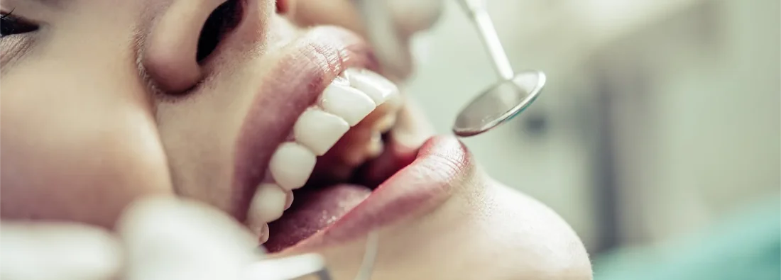Cirurgião dentista segurando uma protese